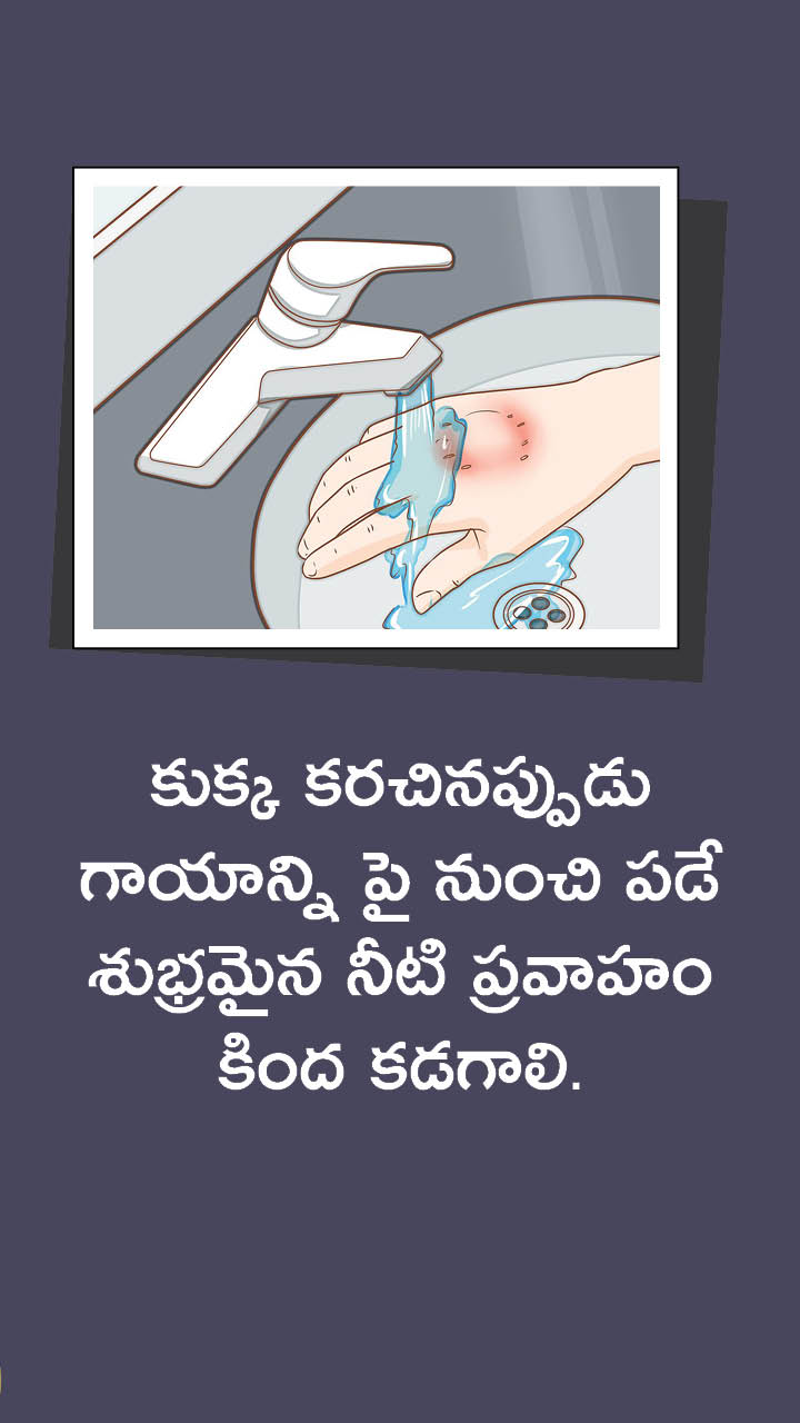 Precautions To Be Taken For Dog Bite Sakshi